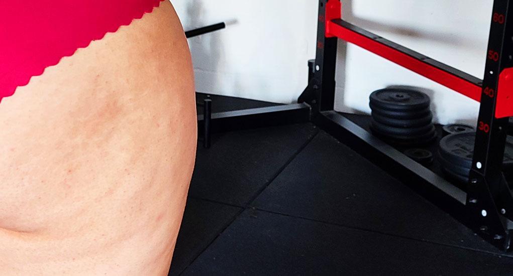 Comment perdre la cellulite ?